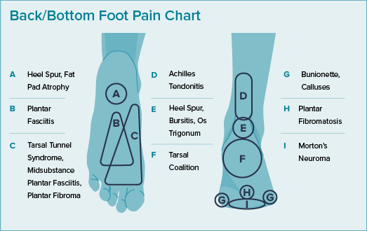 This illustration shows the back and bottom side of a foot with callouts showing the location and names of painful conditions. 